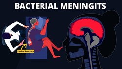 Bacterial Meningitis : Symptoms, Diagnosis, Treatments & Pathology Instructional Video
