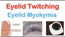Eyelid Twitching (Eyelid Myokymia) | Triggers, Pathophysiology, Symptoms, Diagnosis, Treatment Instructional Video