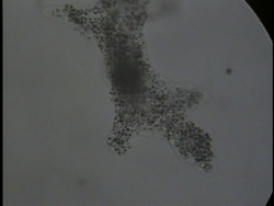 Vida microscópica: protistas Instructional Video