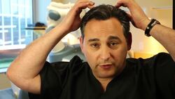 What Is Scalp Reduction? Instructional Video