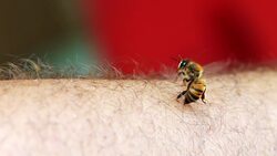 What You Need To Know About Bee Stings Instructional Video