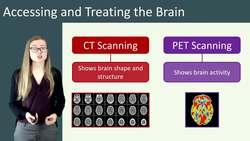Accessing and Treating the Brain and Nervous System: Scanning, Tumors, and Spinal Injuries Instructional Video