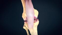 Total Knee Replacement Instructional Video