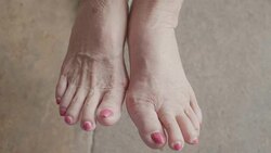 Senior Asian woman got Pain in feet finger joints , Gout Stock Footage