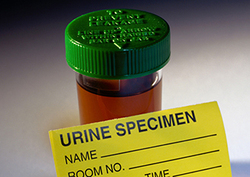 Discovery of Phosphorus Instructional Video