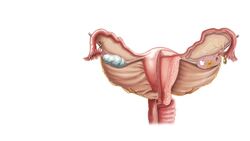 Uterus Instructional Video