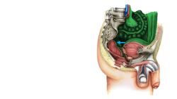 Excavatio rectouterina Instructional Video