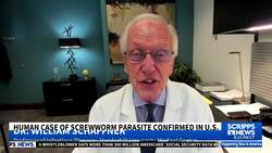 Human case of screwworm parasite confirmed in US News Clip