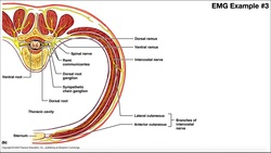 Diagnosing Nerve Damage with EMG [Example 1] | UE, Proximal to Elbow Instructional Video