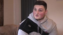 Birmingham man discusses 'unnecessary' shoulder operation News Clip