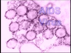 Viruses and Monerans: Virus Shapes and Classification Instructional Video