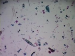 Introduction to Protists Instructional Video