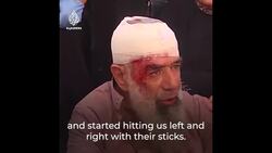 Palestinians arrested, injured as far-right Jews enter Al-Aqsa News Clip