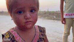 UN concerned about spread of cholera in flood-hit Pakistan News Clip