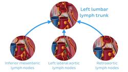 Lymphatics of the posterior abdominal wall Instructional Video