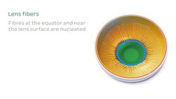 Lens and corpus ciliare Instructional Video