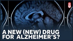 Some Good News in Alzheimer's Treatments Instructional Video