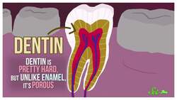 Why Does Sugar Make My Teeth Hurt? Instructional Video