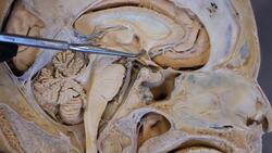 Why Drinking Water Is So Important Instructional Video