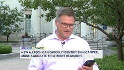 Yale study finds AI aiding in more accurate treatment for skin cancer News Clip