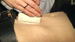 Closeup of a doctor is moving an ultrasound probe on a man's stomach in a hospital. Ultrasound examination of patient performing by physician. Stock Footage