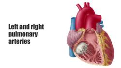Pulmonary arteries Instructional Video