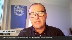 Painful, contagious skin disease spreading in Gaza’s tent camps Instructional Video