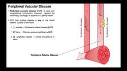 Cardiovascular Disease [Part 1] Intro + Peripheral Vascular Disease Instructional Video