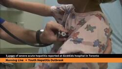 7 cases of severe hepatitis reported at Toronto's SickKids hospital News Clip