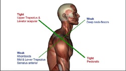 Cervical Protraction & Retraction + Cervicogenic Headaches Intro Instructional Video