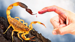 STUNG by Meanest Scorpion in Thailand! Instructional Video