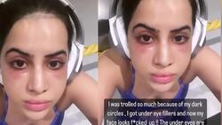 Urfi Javed's under-eye treatment ends in a disaster, says 'even makeup couldn't hide this miserable state of my eyes' News Clip
