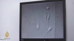 Alabama court ruling on frozen embryos: Several clinics pause fertility treatments News Clip