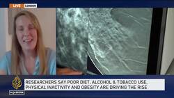 Cancer cases in people below 50 up nearly 80 percent in last three decades News Clip