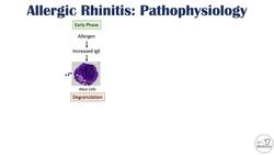 Allergic Rhinitis (Hay Fever): Risk Factors, Pathogenesis, Signs and Symptoms, Diagnosis, Treatment Instructional Video