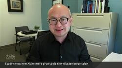Growing hope over a new Alzheimer's drug, but there are side effects News Clip