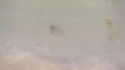 Treating Kala Azar Instructional Video