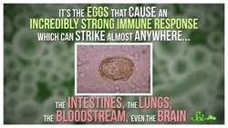 3 Deadly Diseases You've Probably Never Heard Of Instructional Video