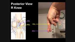 Intracapsular Knee Ligaments The ACL & PCL Instructional Video