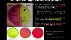 Mannitol Salt Agar (MSA) | Results & Theory Instructional Video