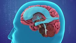 Increase in number of La Crosse Encephalitis infection cases in U.S. children Instructional Video