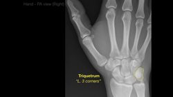 Anatomy of Hand X-rays_Revised Instructional Video
