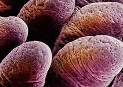 Villi Instructional Video