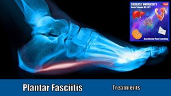 Plantar Fasciitis | Treatments (Self-Manual Therapy & Stretches) Instructional Video