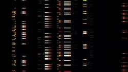 Noise on Analog TV Screen VHS Stock Footage
