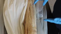 Understanding Growing Pains: What We Know and What We Don't Know Instructional Video