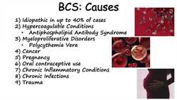“Liver Disease From Blood Clot” (Budd-Chiari Syndrome) Risk Factors, Symptoms, Diagnosis, Treatment Instructional Video