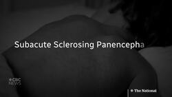 Mother urges parents to vaccinate kids after daughter’s measles death News Clip