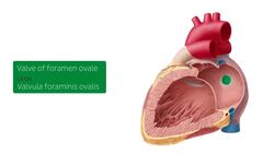 Left atrium and ventricle Instructional Video