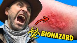 STUNG by the Devil's Toilet Paper! Instructional Video